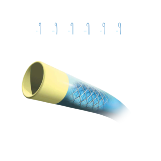 VISTA BRITE TIP™ Catéter Guía IZQ